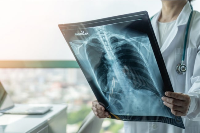En kvinnlig läkare eller sjuksköterska håller upp en röntgenplåt.